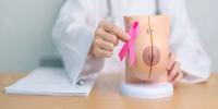 Breast cancer symptoms