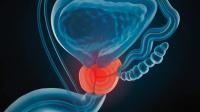 Prostate