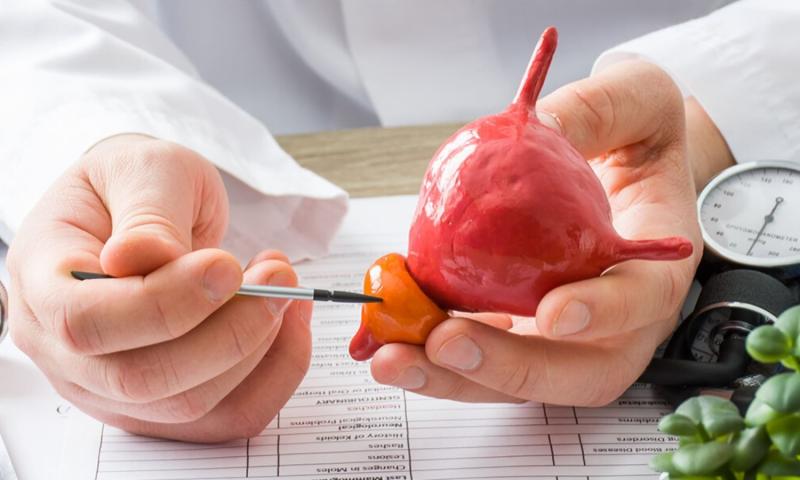 Essential Tips for Maintaining Prostate Health