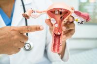Ovarian cysts