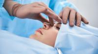 Rhinoplasty operation Nose job