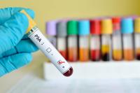 PSA analysis PSA analysis