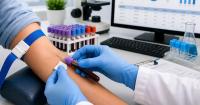 تحليل السكر التراكمي HbA1c تحليل السكر التراكمي HbA1c