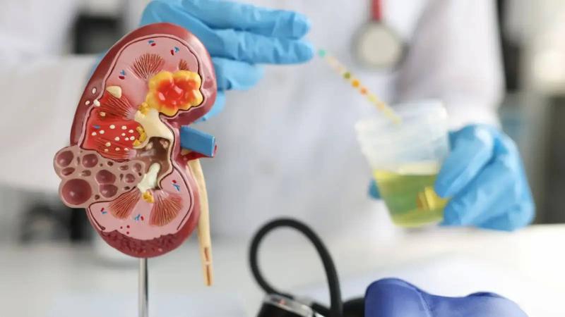 Cost of Kidney Function Tests in Lebanon: What to Know