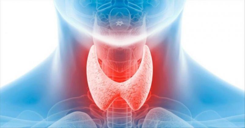 Cost of TSH Thyroid Test in Lebanon: A Comprehensive Guide