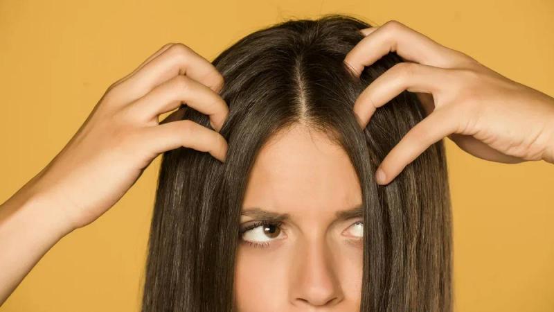 Top Shampoo Choices for Oily Hair Loss