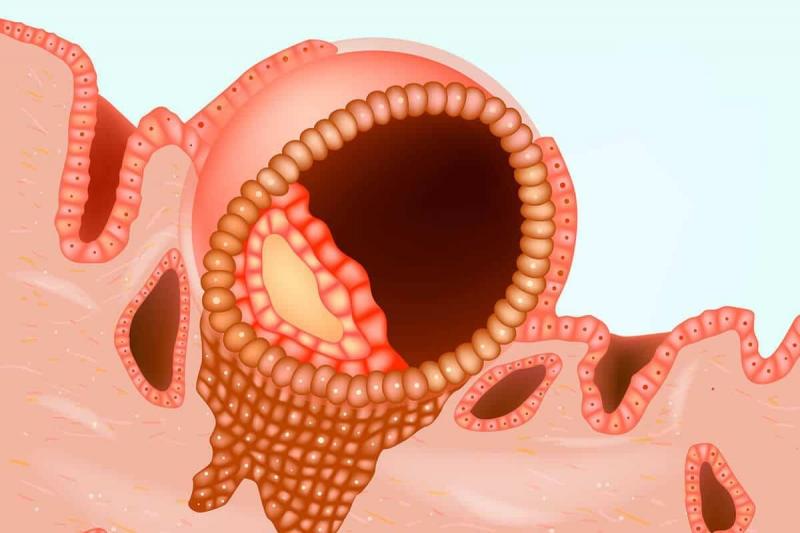 Signs of Successful Egg Fertilization and Implantation