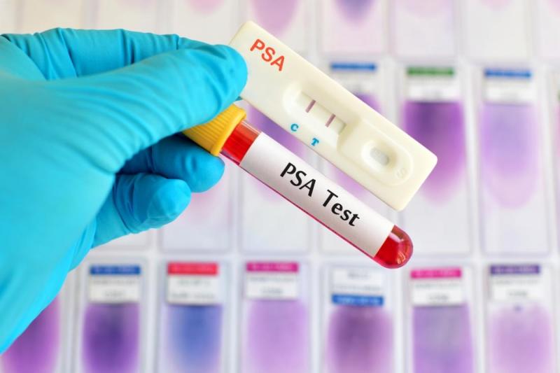 Understanding PSA Test Costs in Lebanon