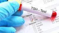 تحليل TSH في لبنان تحليل TSH في لبنان