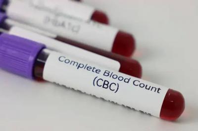 كم سعر تحليل CBC في لبنان؟
