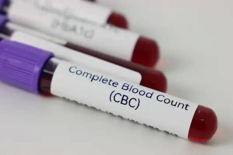 How Much Does a CBC Test Cost in Lebanon?