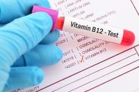 ما المعدل الطبيعي لفيتامين B12؟
ما المعدل الطبيعي لفيتامين B12؟