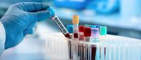 Laboratories conducting blood tests Laboratories for blood tests