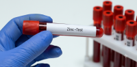 Zinc analysis Zinc analysis