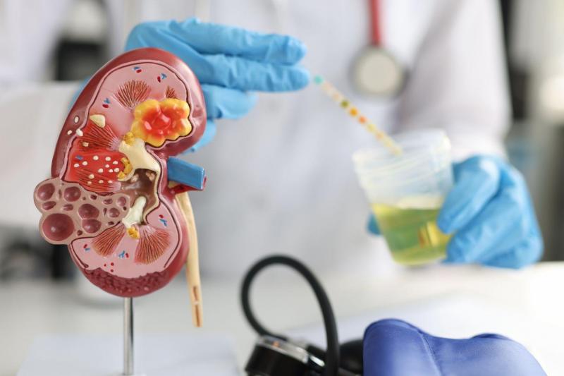 Can Kidney Deposits Cause Burning Urination?