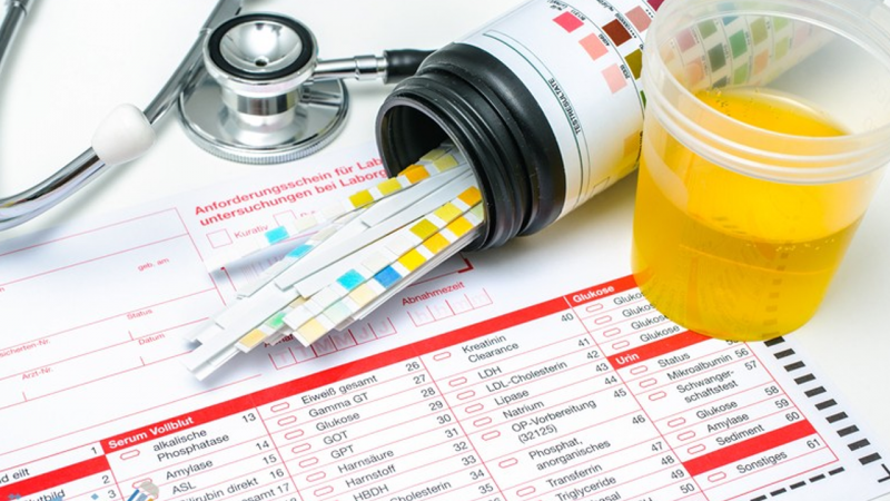 Urinanalysis Pricing in Lebanon: What You Need to Know