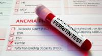 تحليل مخزون الحديد Ferritin تحليل مخزون الحديد Ferritin