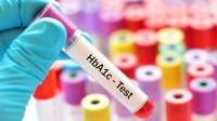 تحليل السكر التراكمي HbA1c تحليل السكر التراكمي HbA1c