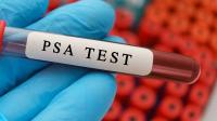 PSA analysis PSA analysis