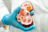 "The best kidney doctor in Beirut." The best kidney doctor in Beirut