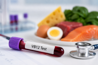 فحص فيتامين B12 فحص فيتامين B12