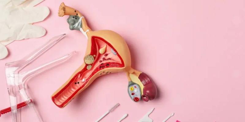Top Gynecologists for Treating Vaginal Infections in Lebanon