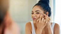 Blackhead treatment Blackhead treatment