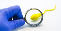 Low sperm motility Weak sperm motility