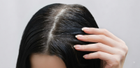 Premature graying in women Premature graying in women