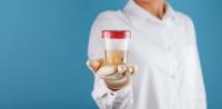 Urine culture test Urine culture test