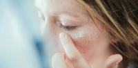 Dry skin