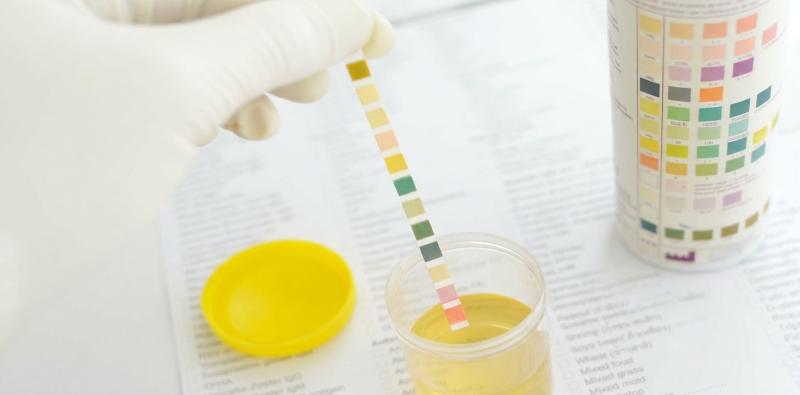 The Best Tests for Diagnosing Urinary Tract Infections (UTIs)