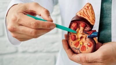 أفضل علاج لترسبات الكلى