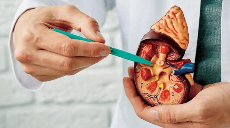 Top Remedies for Kidney Deposits: A Comprehensive Guide