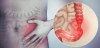 Symptoms of irritable bowel syndrome Symptoms of irritable bowel syndrome