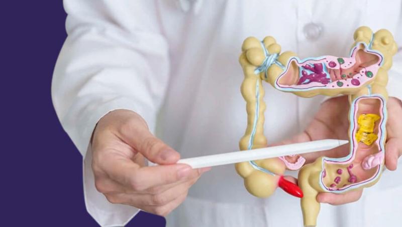 Understanding IBS: 5 Common Symptoms to Recognize