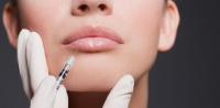 Lip augmentation Lip enlargement