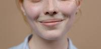 Appearance of lines around the mouth The appearance of lines around the mouth
