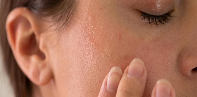 Causes and Treatments for Severe Skin Dryness