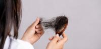 Sudden hair loss Sudden hair loss