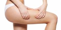 Thigh lift procedure Thigh lift procedure