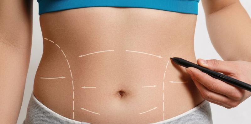 Top Body Sculpting Surgeons in Lebanon Enhancing Aesthetic Standards