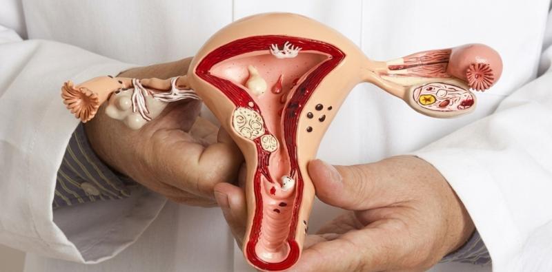 Common Yeast Infections in Women: Symptoms and Diagnosis
