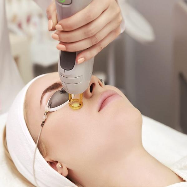 Revolutionary Laser Treatment for Dark Circles: What You Need to Know