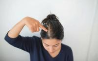 Hair loss