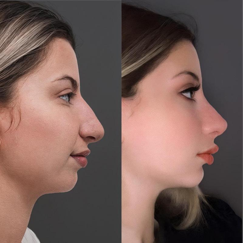 Cosmetic Surgery Prices in Lebanon 2026: A Comprehensive Guide
