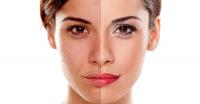 Facial tanning