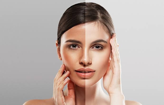 Causes of Facial Darkening and Skin Lightening Methods