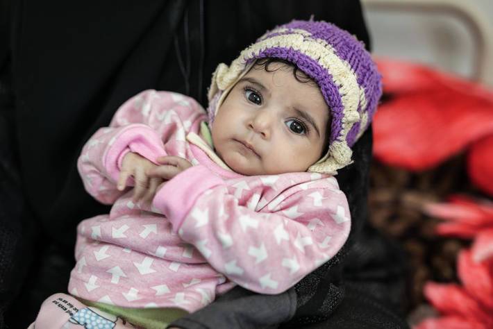 أرقام مرعبة لمنظمات الأمم المتحدة فيما يتعلق بالازمة الإنسانية في اليمن