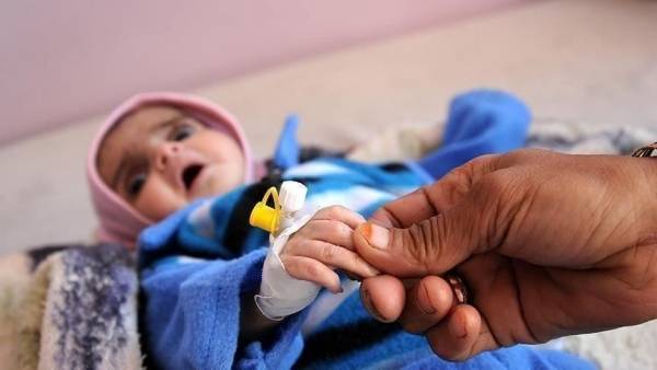 اليونيسف: 6 مليون طفل يمني على مشارف المجاعة